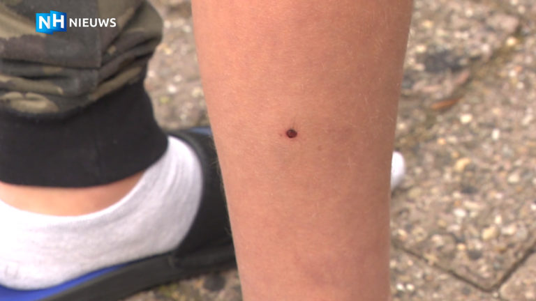 Elfjarige Jimmi uit Oudkarspel beschoten met luchtbuks: “Ik hoorde ‘zoef, pats'”
